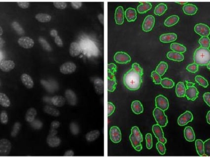 تحلیل داده های پزشکی، جدول، متن و تصویر 7 شناسایی سلول